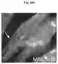 Fig. 20 - METHODS AND COMPOSITIONS FOR MITOCHONDRIAL REPLACEMENT THERAPY