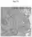 Fig. 23 - METHODS AND COMPOSITIONS FOR MITOCHONDRIAL REPLACEMENT THERAPY