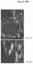 Fig. 32 - METHODS AND COMPOSITIONS FOR MITOCHONDRIAL REPLACEMENT THERAPY