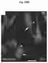 Fig. 46 - METHODS AND COMPOSITIONS FOR MITOCHONDRIAL REPLACEMENT THERAPY