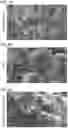 Fig. 03 - Biological Scaffold Comprising Therapeutic Cells