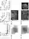 Fig. 04 - Biological Scaffold Comprising Therapeutic Cells