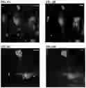 Fig. 22 - Methods of producing pancreatic hormones