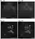Fig. 33 - Methods of producing pancreatic hormones