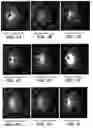 Fig. 02 - Method of synthesizing custard apple peel nanoparticles