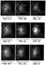 Fig. 02 - Method of synthesizing custard apple peel nanoparticles