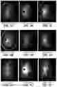 Fig. 03 - Method of synthesizing custard apple peel nanoparticles