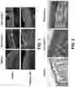 Fig. 02 - COLLAGEN 7 COMPOSITIONS AND METHODS OF USING THE SAME