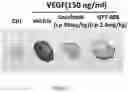 Fig. 02 - Method for treating ocular diseases