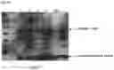 Fig. 33 - Genetically stable recombinant modified vaccinia Ankara (rMVA) vaccines and methods of preparation thereof