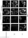 Fig. 09 - Devices and processes for Cherenkov-activated nuclear-targeted photodynamic therapy