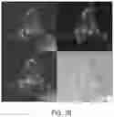 Fig. 03 - Methods of treatment using ultrasmall nanoparticles to induce cell death of nutrient-deprived cancer cells via ferroptosis