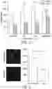 Fig. 04 - COMPOUNDS AND COMPOSITIONS USEFUL AS RADIOTRACERS FOR IMAGING OF REACTIVE OXIDATIVE SPECIES