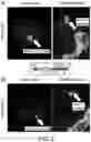 Fig. 07 - COMPOUNDS AND COMPOSITIONS USEFUL AS RADIOTRACERS FOR IMAGING OF REACTIVE OXIDATIVE SPECIES