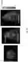 Fig. 07 - DEVICES AND METHODS FOR RADIOPHARMACEUTICAL SYNTHESIS