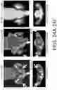 Fig. 24 - Compositions And Methods For Imaging Immune Cells