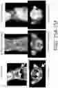 Fig. 26 - Compositions And Methods For Imaging Immune Cells