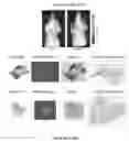 Fig. 37 - Compositions And Methods For Imaging Immune Cells