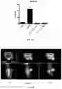 Fig. 44 - Compositions And Methods For Imaging Immune Cells