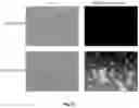 Fig. 59 - Compositions And Methods For Imaging Immune Cells