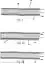 Fig. 04 - Biodegradable absorbent articles