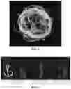 Fig. 08 - Medical material produced using collagen and method for producing same