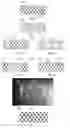 Fig. 03 - Implantable scaffolds for treatment of sinusitis and method of reducing inflammation