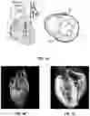 Fig. 02 - Three-dimensional bioprinting of cardiac patch with anisotropic and perfusable architecture