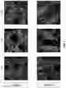 Fig. 07 - Three-dimensional bioprinting of cardiac patch with anisotropic and perfusable architecture