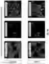 Fig. 08 - Three-dimensional bioprinting of cardiac patch with anisotropic and perfusable architecture