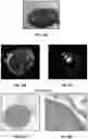 Fig. 28 - Three-dimensional bioprinting of cardiac patch with anisotropic and perfusable architecture