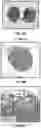 Fig. 35 - Three-dimensional bioprinting of cardiac patch with anisotropic and perfusable architecture
