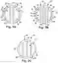 Fig. 03 - Reinforced tissue graft