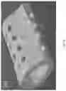 Fig. 08 - Growth factor transduced cell-loaded ceramic scaffold for bone regeneration and repair