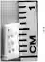 Fig. 09 - Growth factor transduced cell-loaded ceramic scaffold for bone regeneration and repair