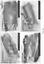 Fig. 13 - Growth factor transduced cell-loaded ceramic scaffold for bone regeneration and repair