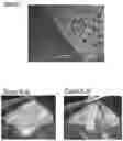 Fig. 08 - HAEMOSTATIC DEVICE
