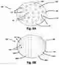 Fig. 07 - Apparatus for wound therapy