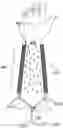 Fig. 01 - Suction-based medical dressing and method of dermal irrigation