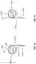 Fig. 08 - Suction-based medical dressing and method of dermal irrigation