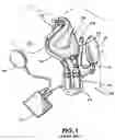 Fig. 02 - Method and apparatus for long-term assisting a left ventricle to pump blood