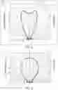 Fig. 06 - Priming sensor for a medical fluid delivery system