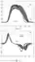 Fig. 15 - Priming sensor for a medical fluid delivery system
