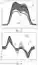 Fig. 16 - Priming sensor for a medical fluid delivery system