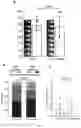 Fig. 08 - Replication or mitigation of low frequency vibration and other physical factors to enhance the effect of thrombolysis on patients with ischemic stroke