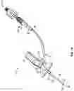 Fig. 02 - Occlusion detection devices, systems, and methods