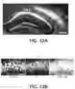 Fig. 13 - Methods and devices for providing a stimulus to a subject to induce gamma oscillations