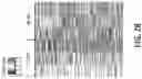 Fig. 29 - Methods and devices for providing a stimulus to a subject to induce gamma oscillations