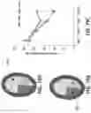 Fig. 80 - Methods and devices for providing a stimulus to a subject to induce gamma oscillations