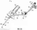 Fig. 02 - Catheter system clamp, systems, and methods